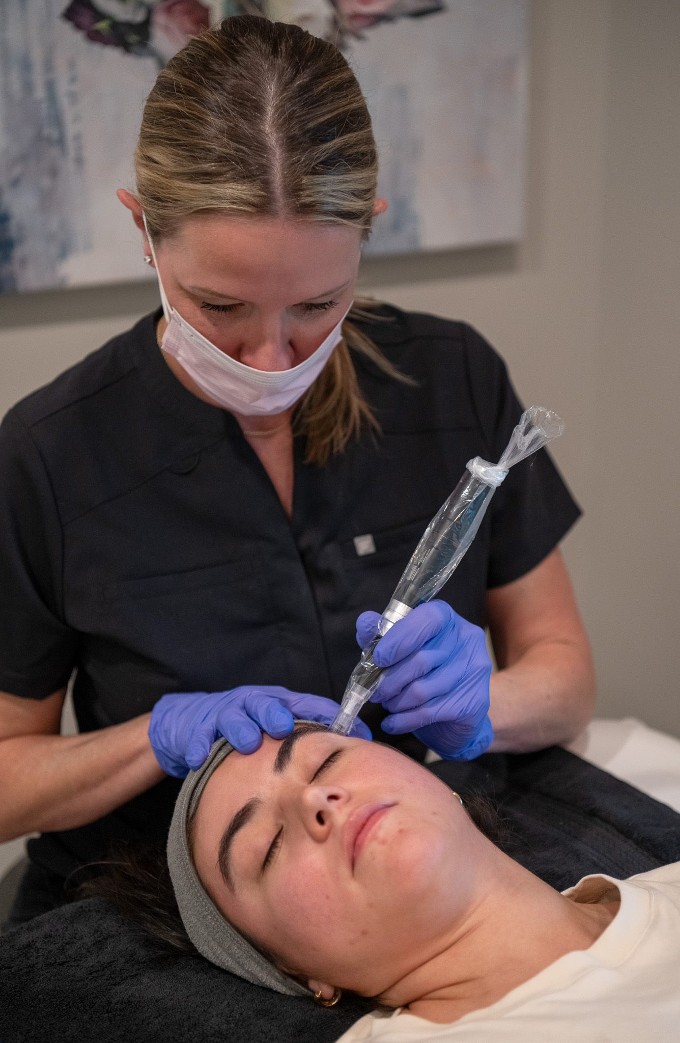 Microneedling at 512 Skincare